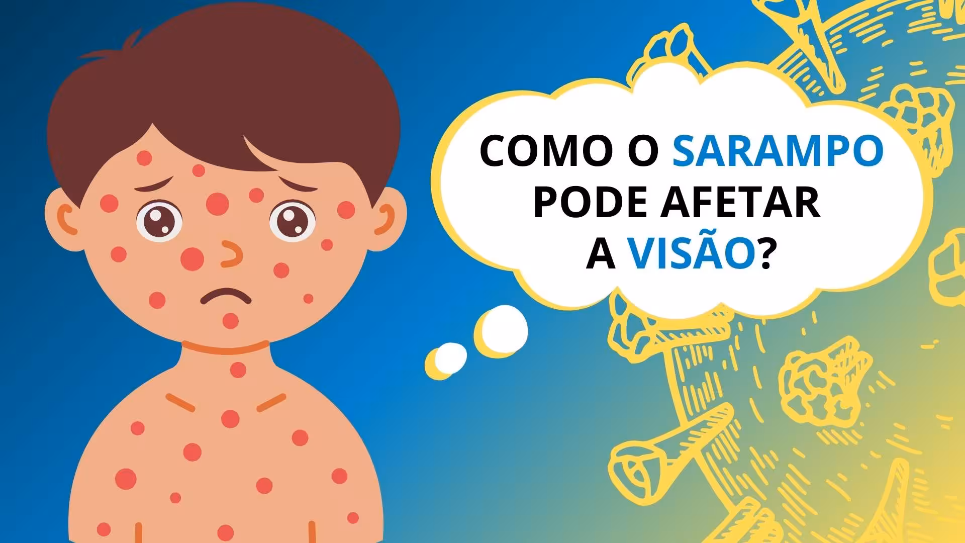Sarampo e as suas complicações podem afetar a saúde visual