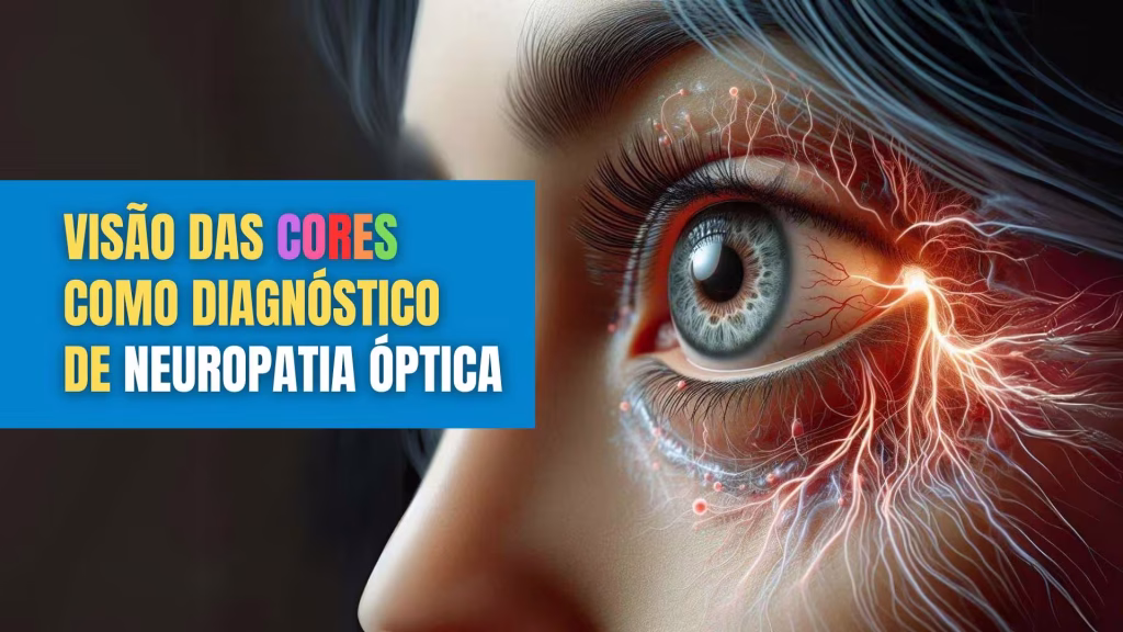 Visão das cores como diagnostico de neuropatia óptica