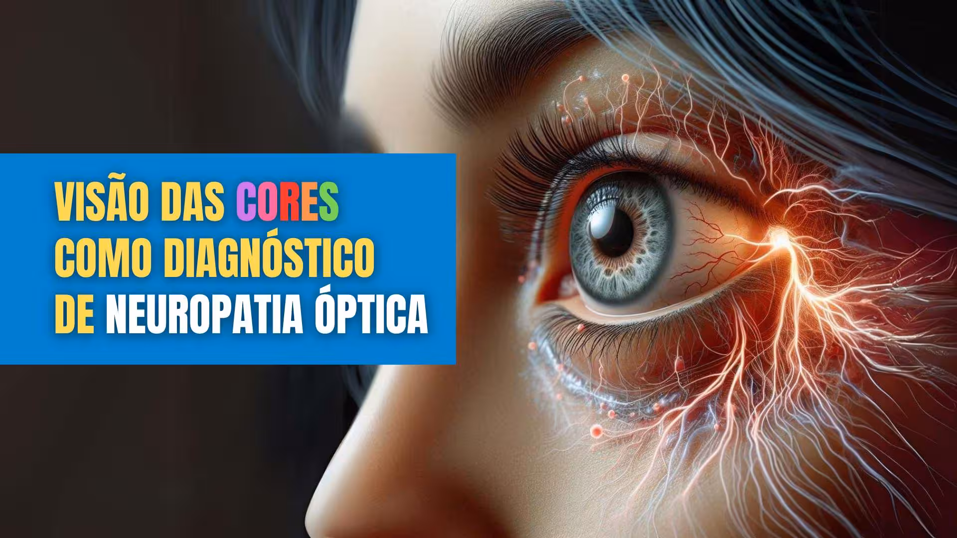 Visão das cores como diagnostico de neuropatia óptica