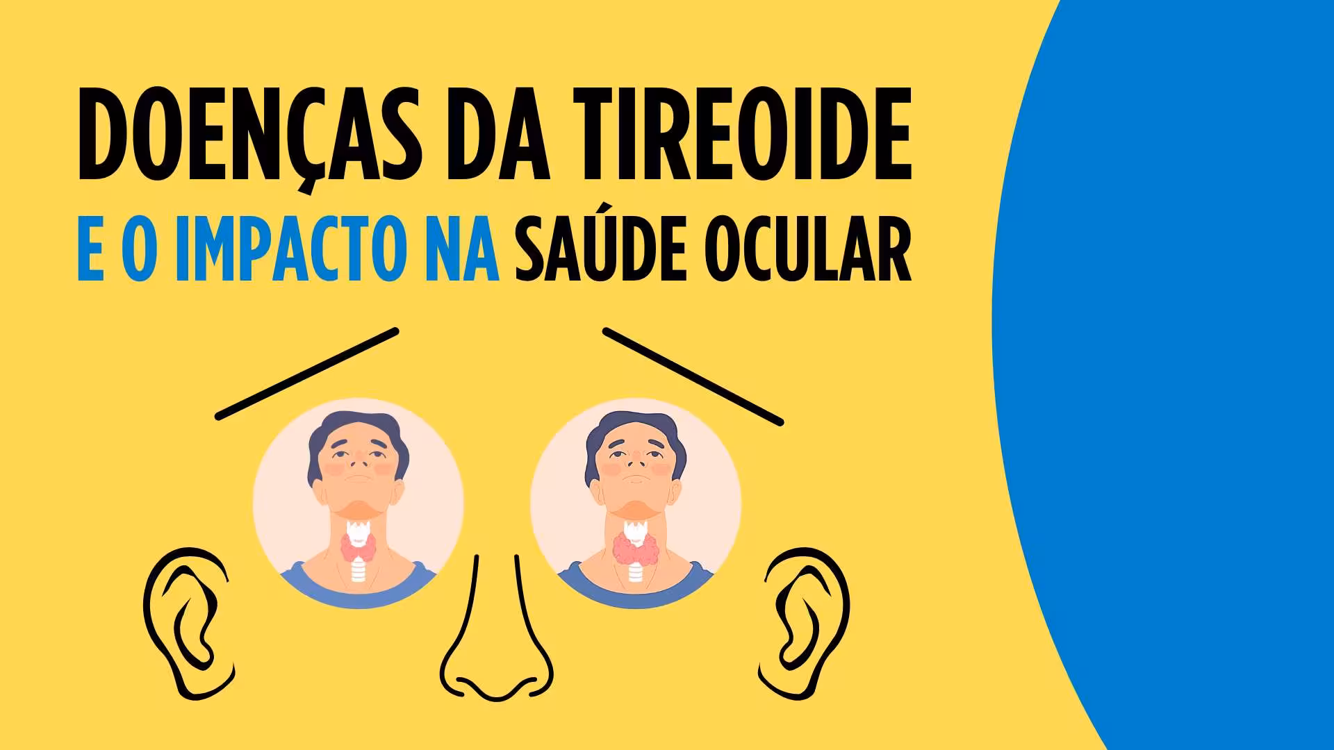 Doenças da tiroide e o impacto na saúde ocular