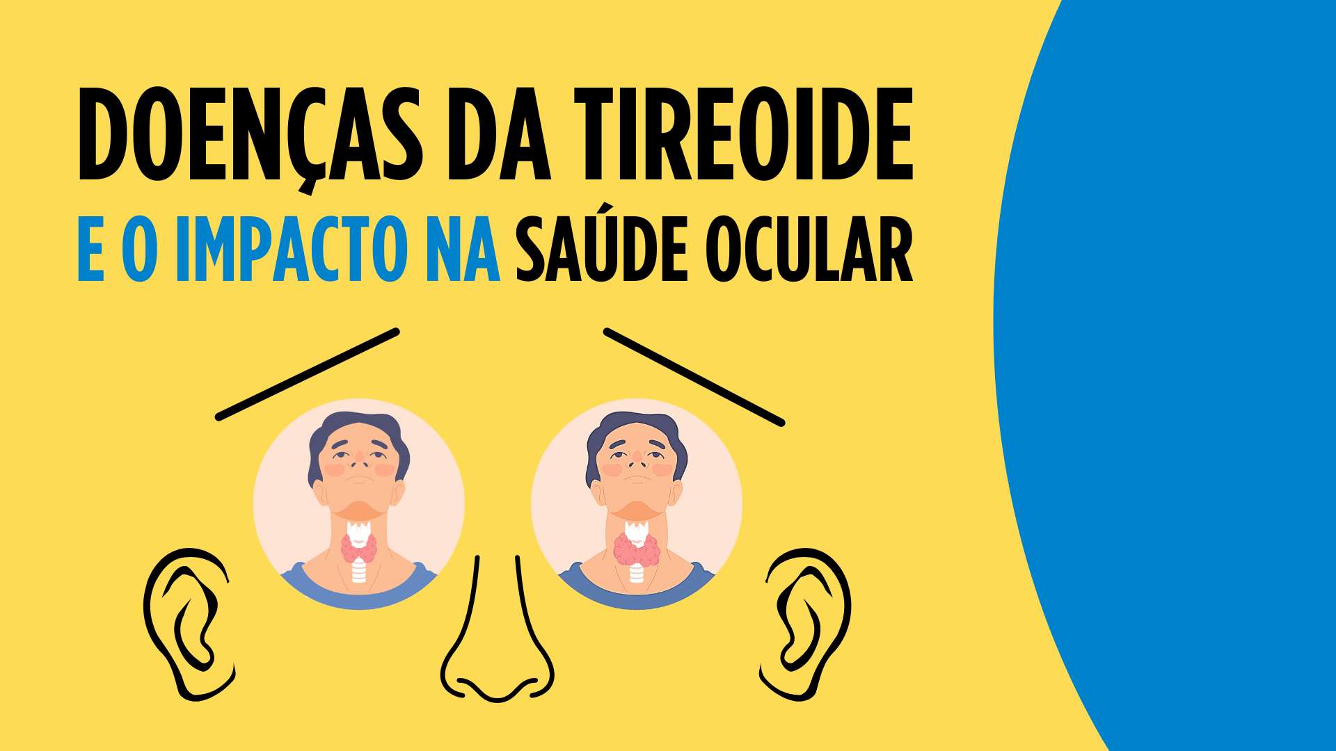 Doenças da tiroide e o impacto na saúde ocular