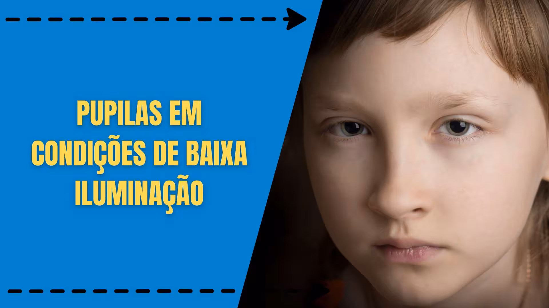 Sabe o que acontece com a Pupila em Condições de Baixa Iluminação?